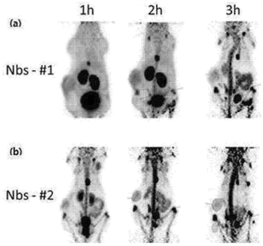 Neovascular-targeting contrast medium composition and method for preparing same