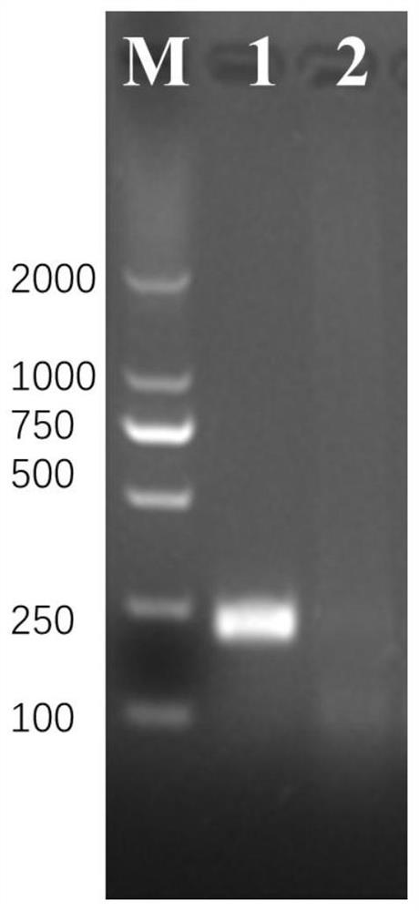 RPA primer and method for detecting schistosoma japonicum katsurada