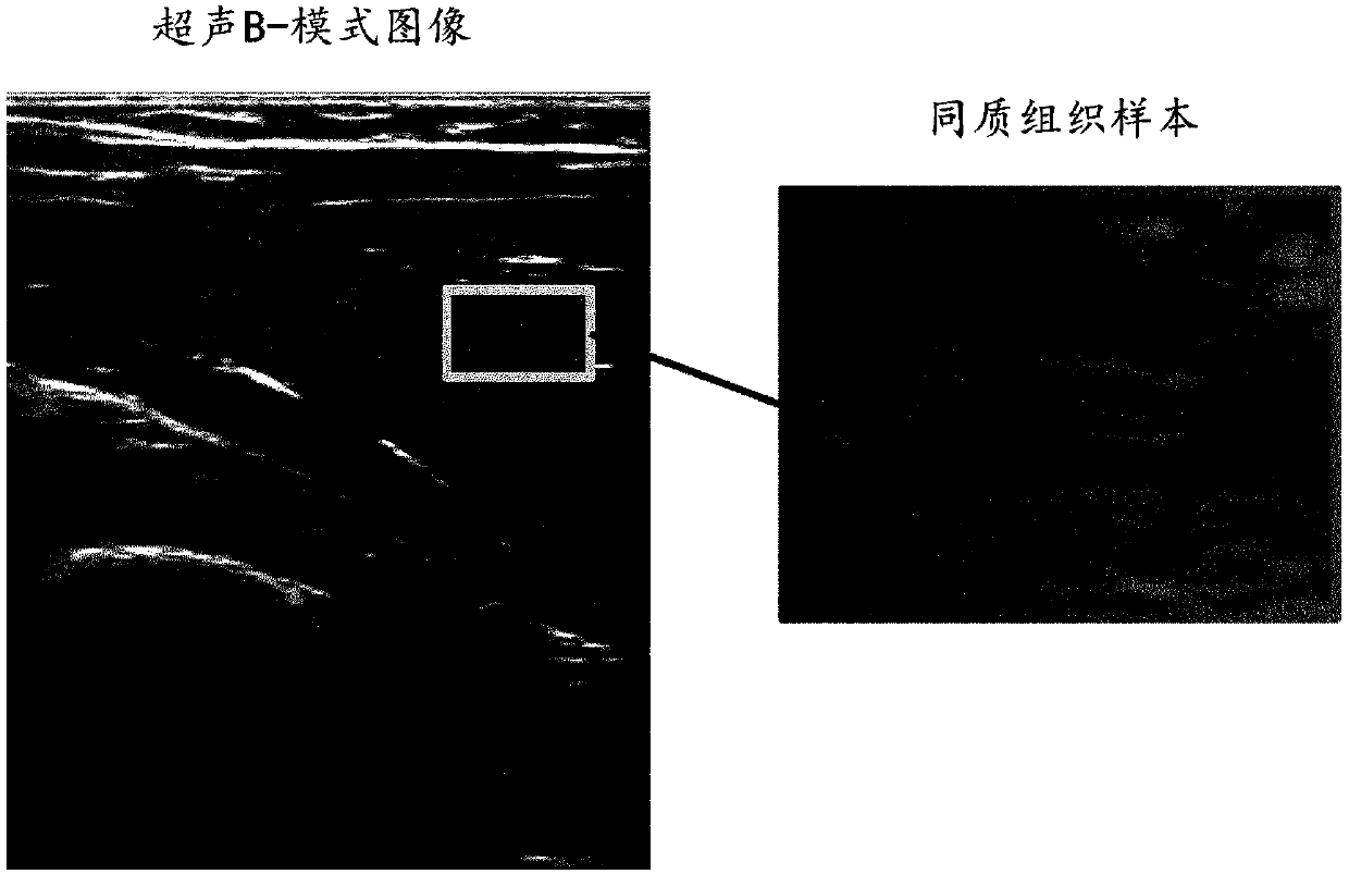 Method and apparatus for generating an ultrasound scatterer representation