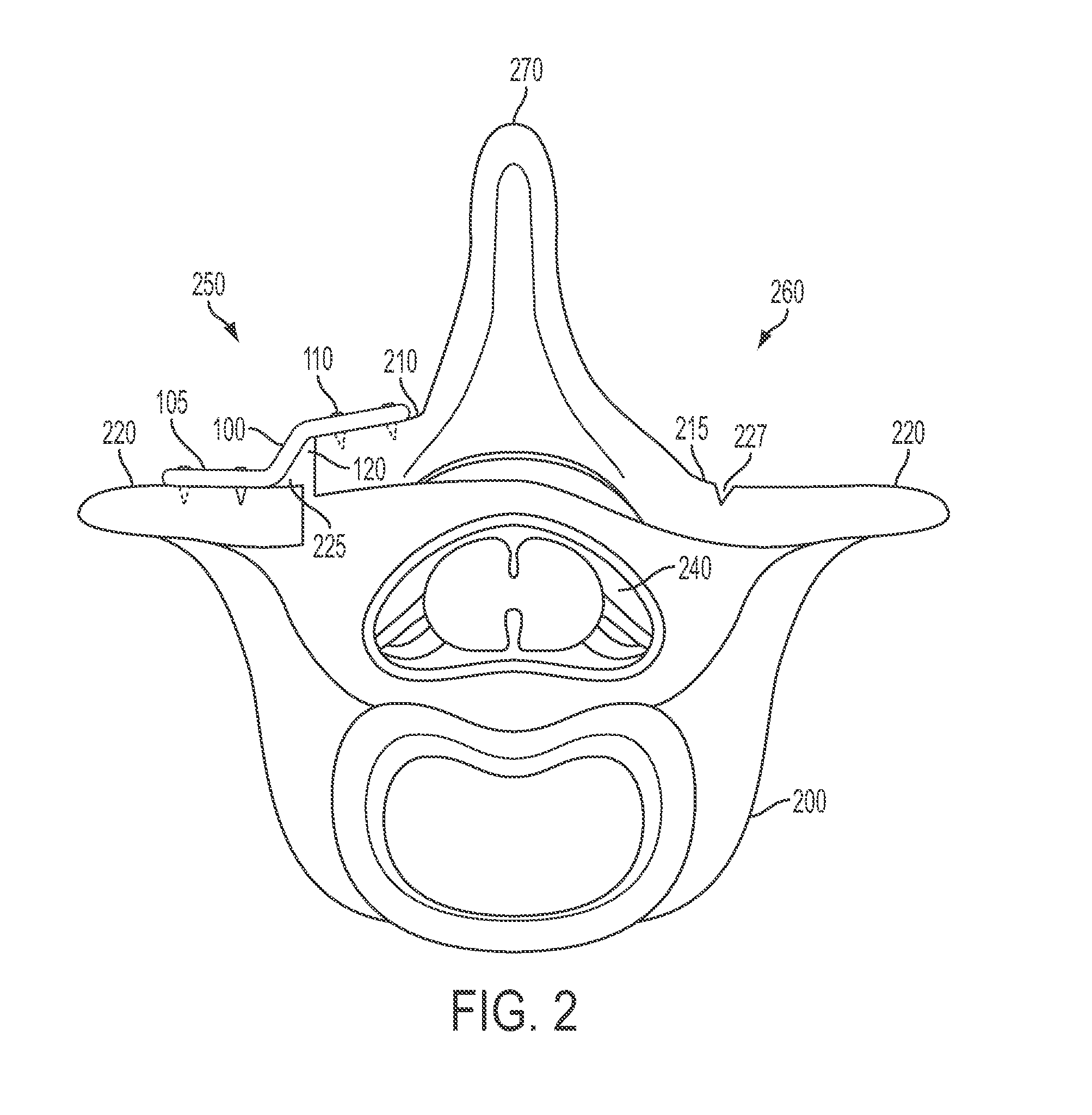 Surgical access system