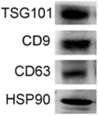 Application of adipose-derived mesenchymal stem cell exosome in preparation of medicines for obesity treatment