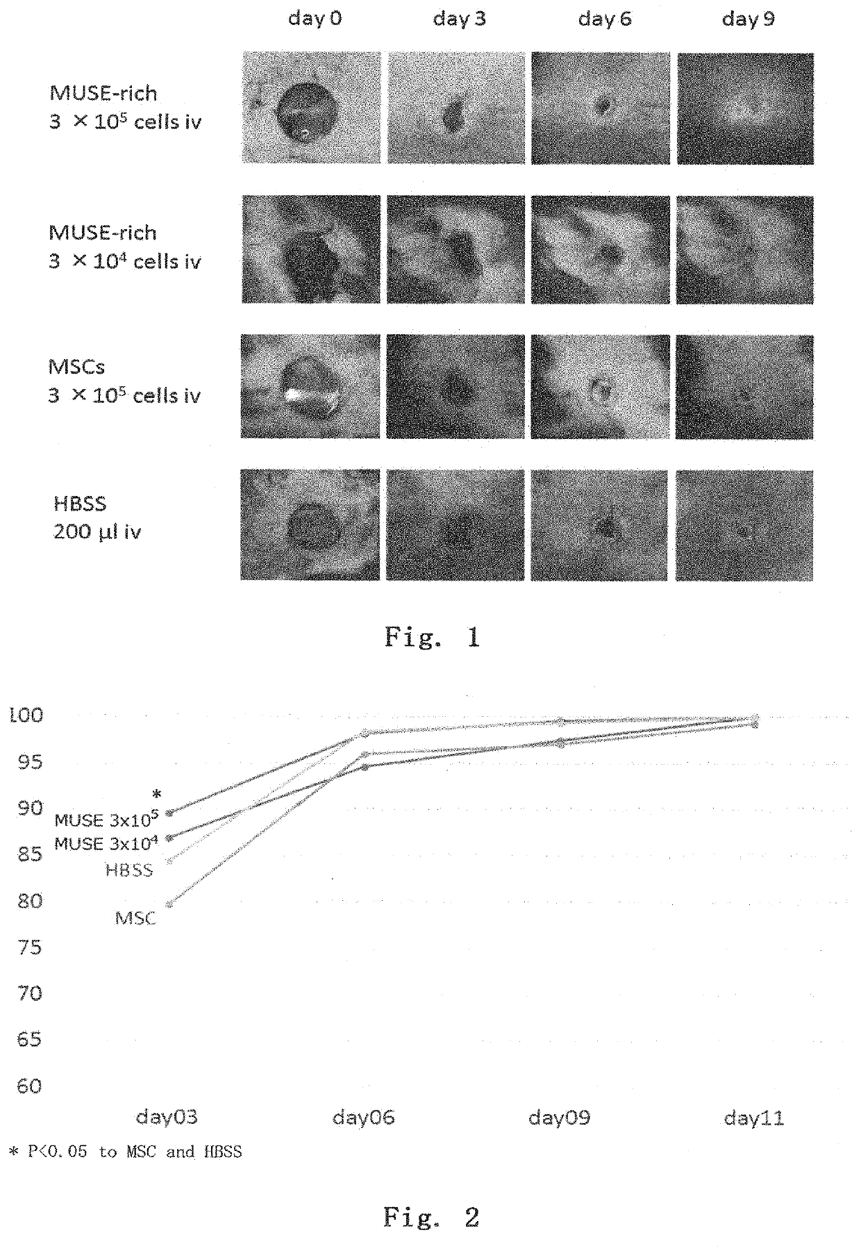 Treatment agent for epidermolysis bullosa