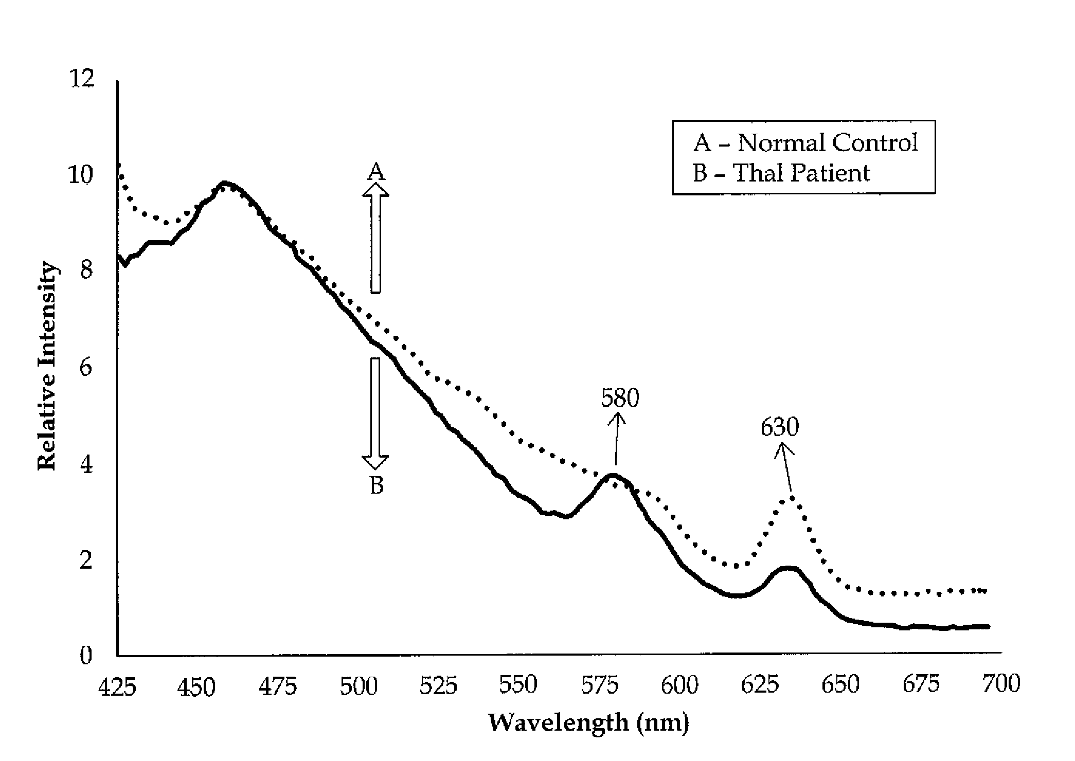 Method of detecting thalassemia by optical analysis of blood components