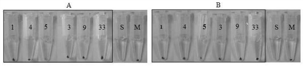 Marine Streptomyces dut11 and its anti-complement activity application