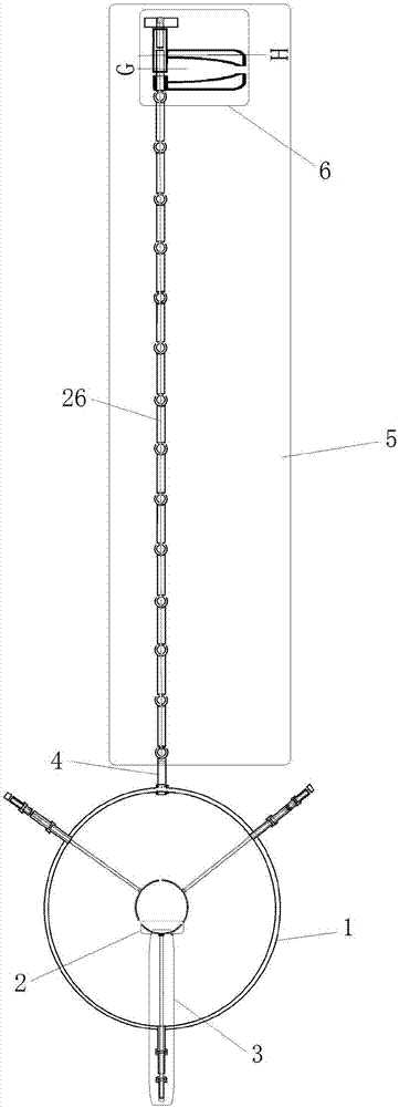 Minimally invasive tissue expander