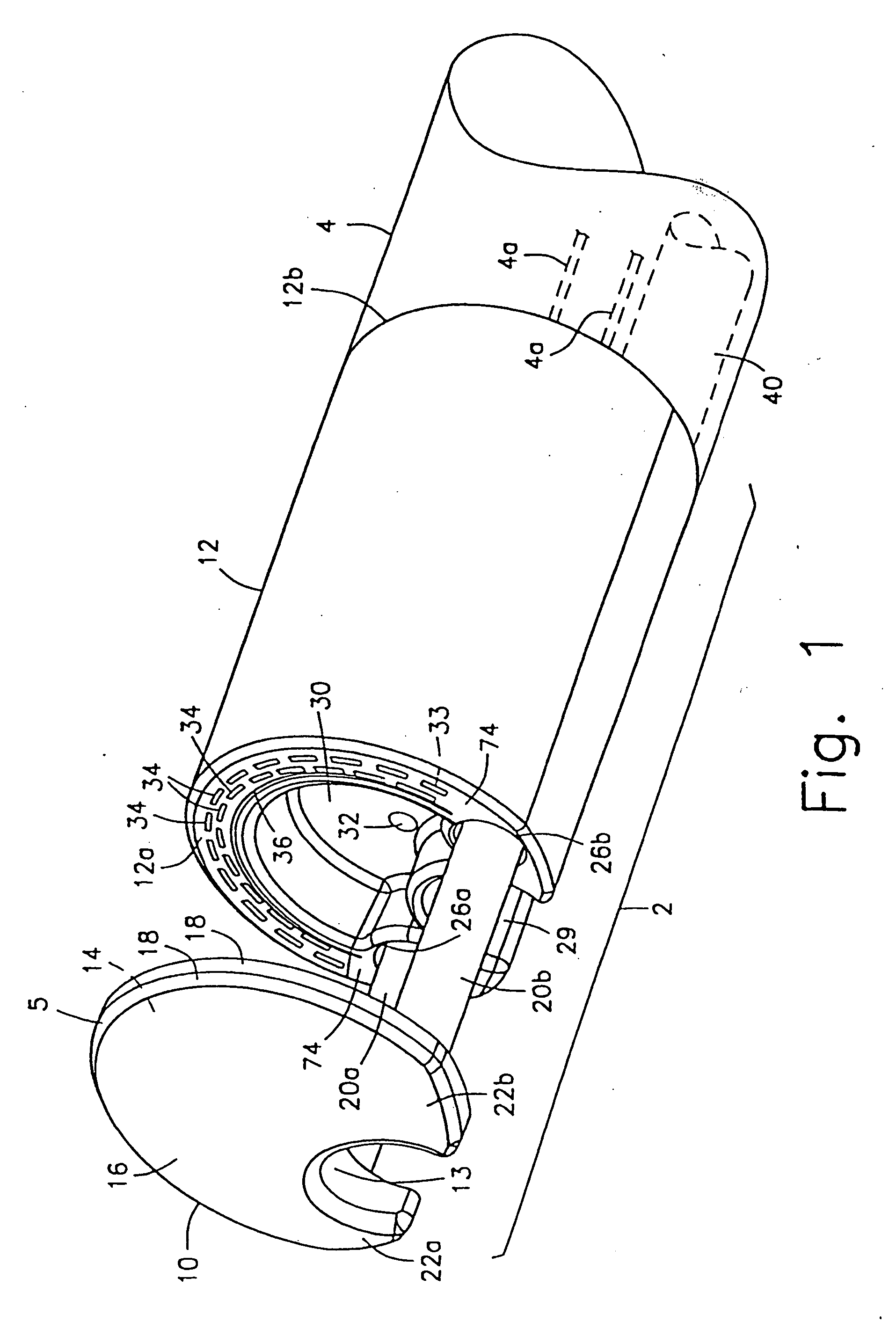 Method and device for full thickness resectioning of an organ