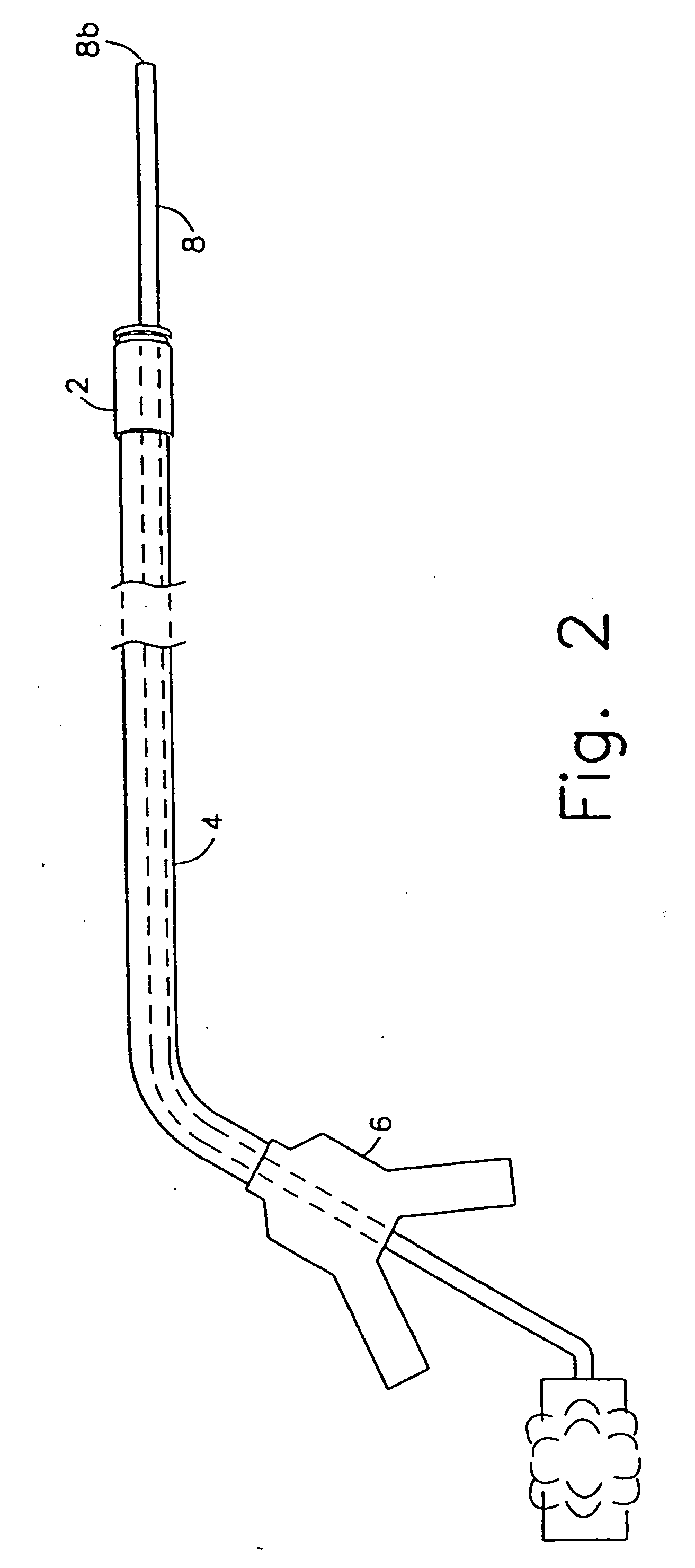 Method and device for full thickness resectioning of an organ