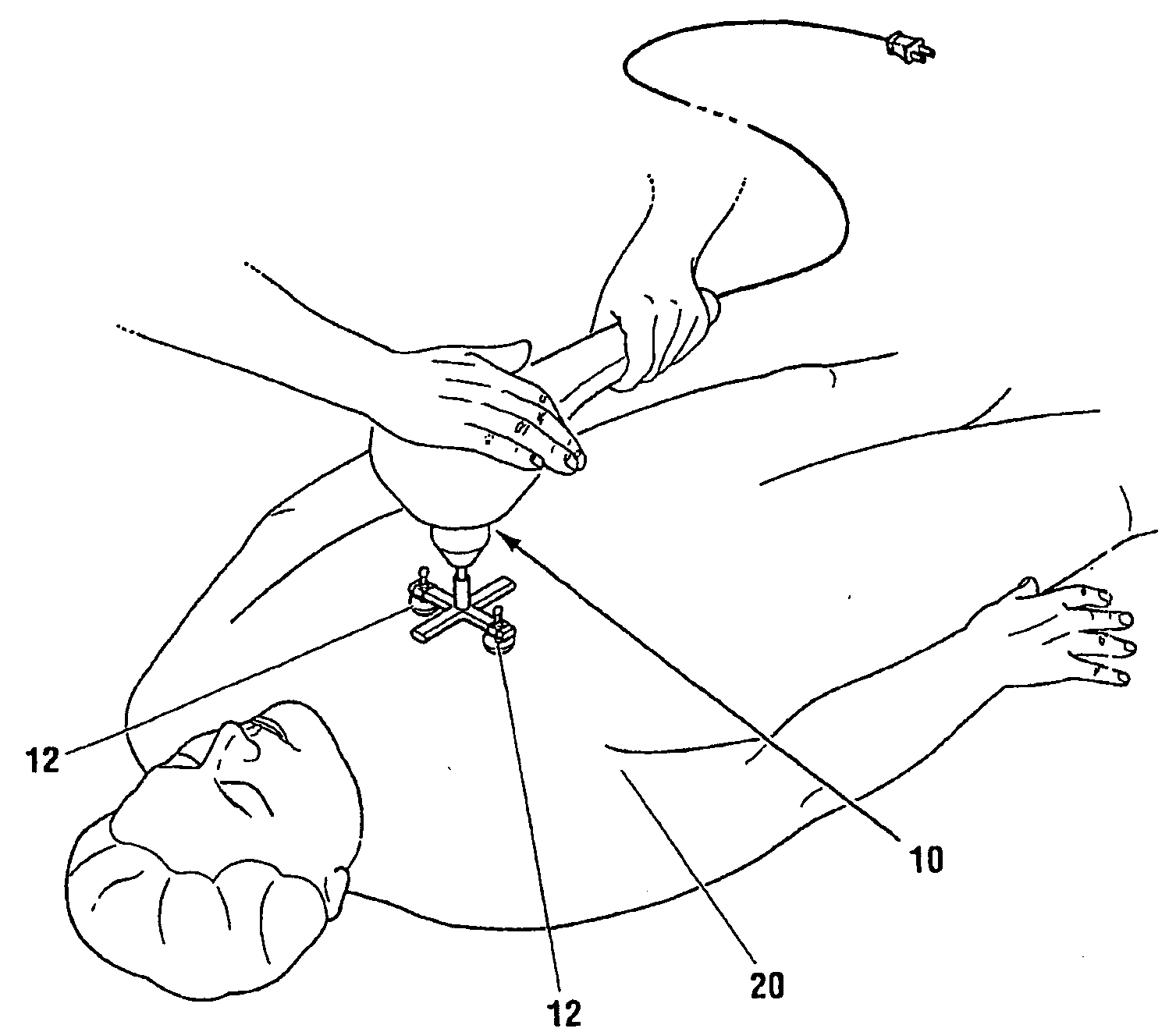 Randomic vibration for treatment of blood flow disorders