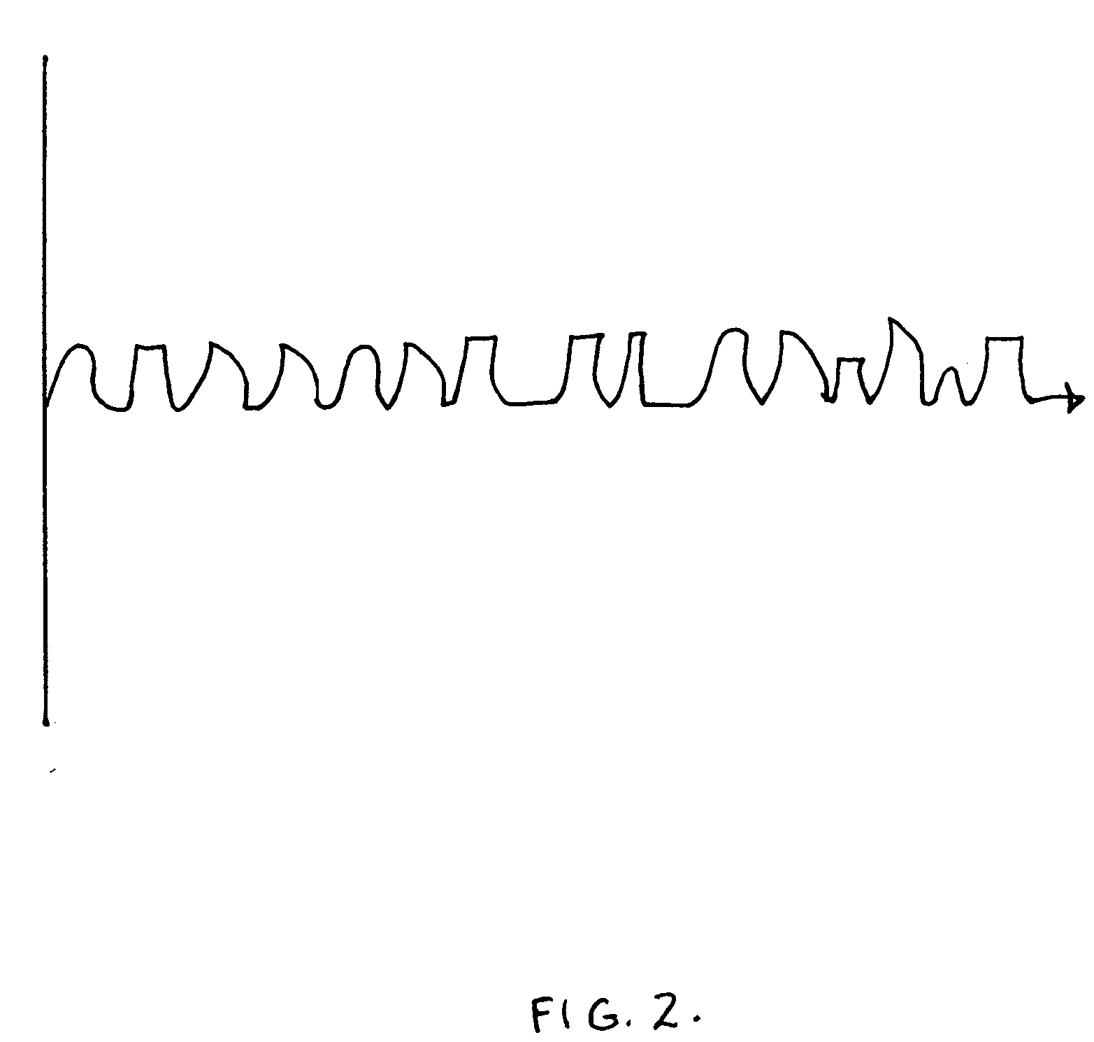 Randomic vibration for treatment of blood flow disorders