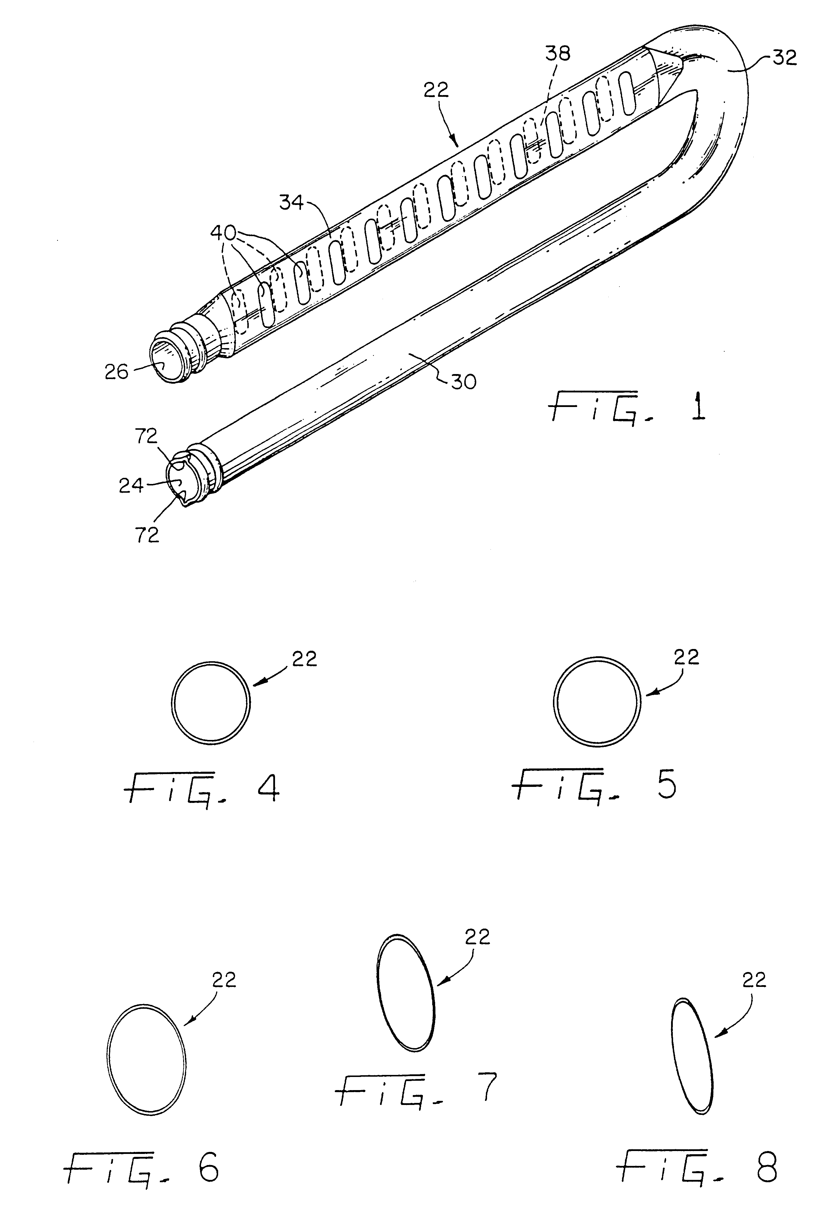 Enhanced tubular heat exchanger