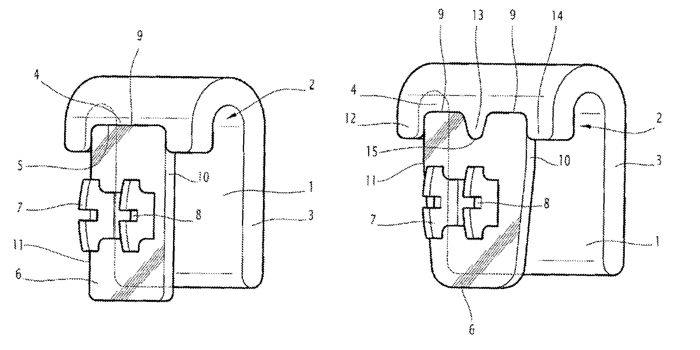 Individualized jig for orthodontic braces, assembly formed by that jig, a base and a bracket, and its design methods