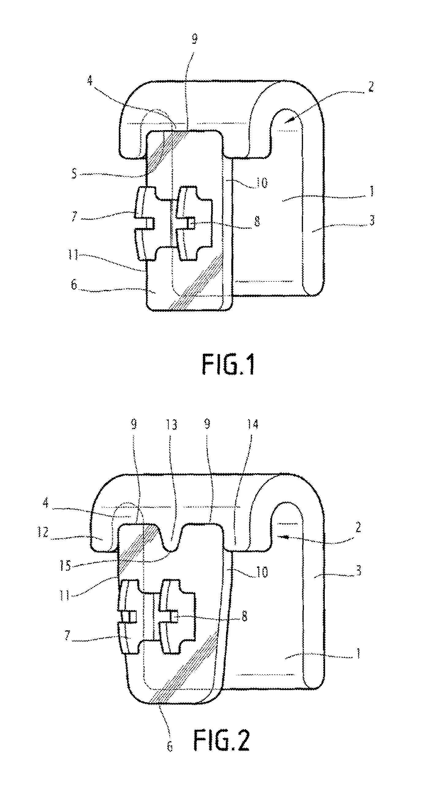 Individualized jig for orthodontic braces, assembly formed by that jig, a base and a bracket, and its design methods