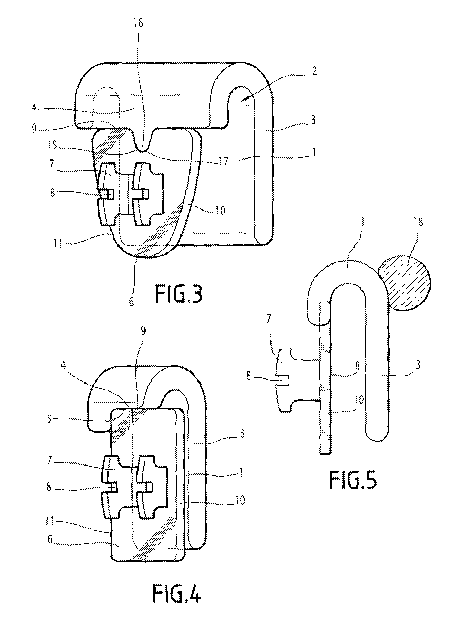 Individualized jig for orthodontic braces, assembly formed by that jig, a base and a bracket, and its design methods