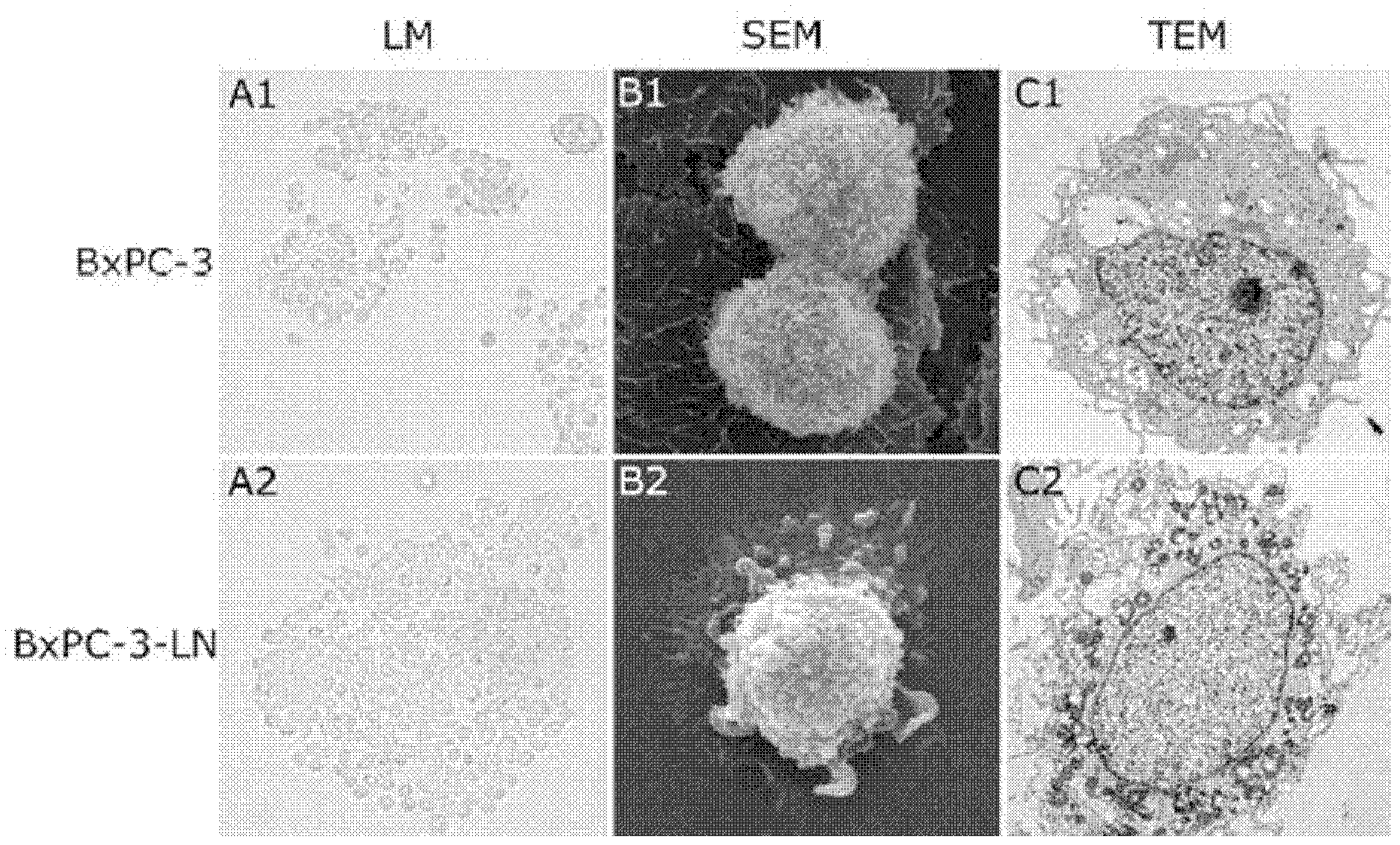 Pancreatic cancer cell line with lymphatic channel high migration activity