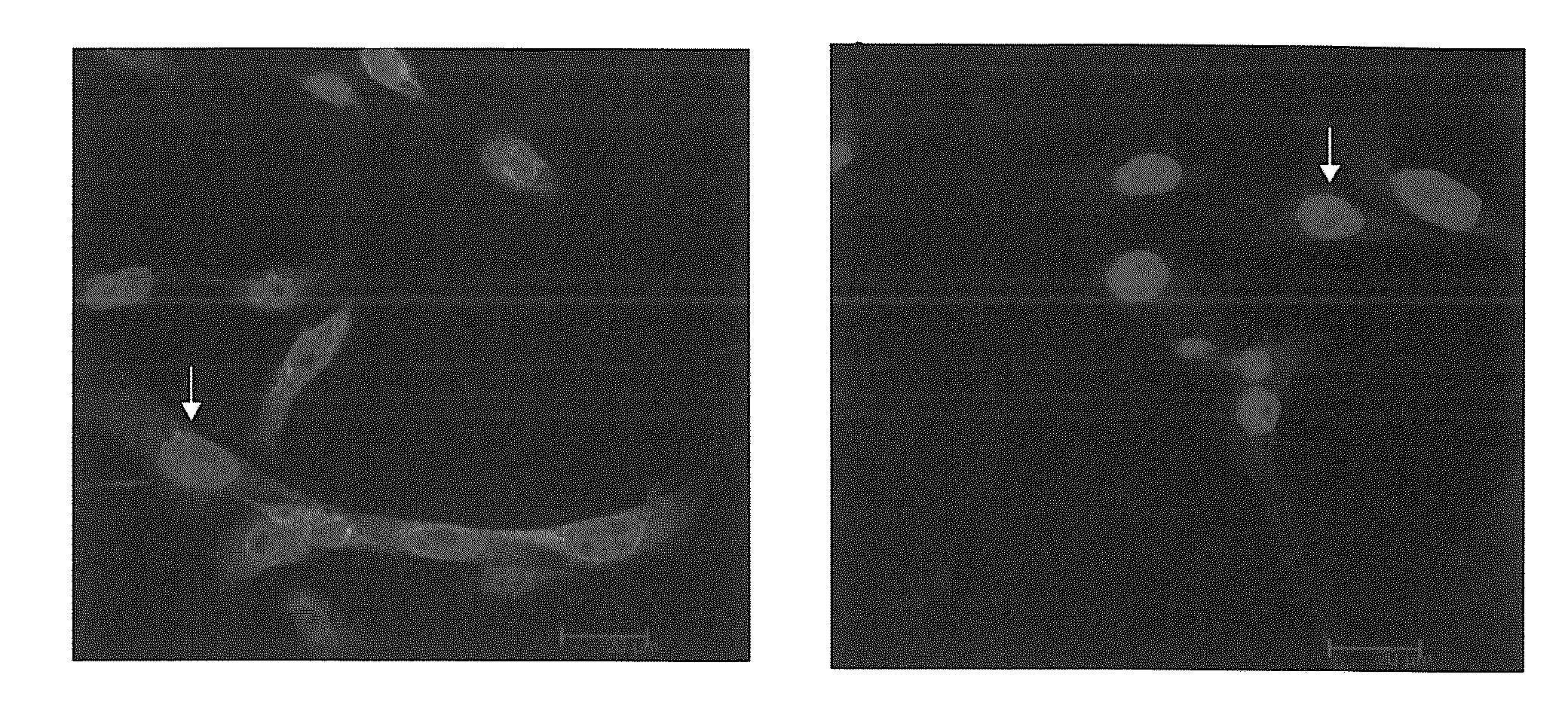 Methods and apparatus for diagnosis and/or prognosis of cancer