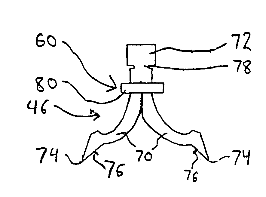 Vascular sheath with bioabsorbable puncture site closure apparatus and methods of use