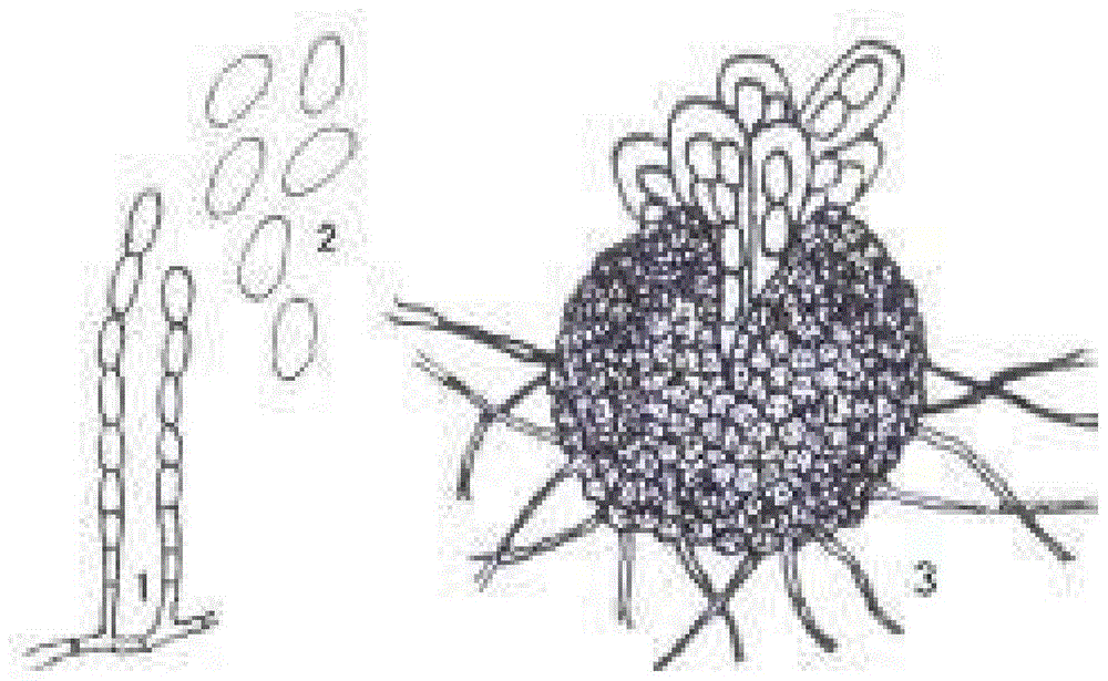 Intelligent recognition method of spore pictures of wheat powdery mildew