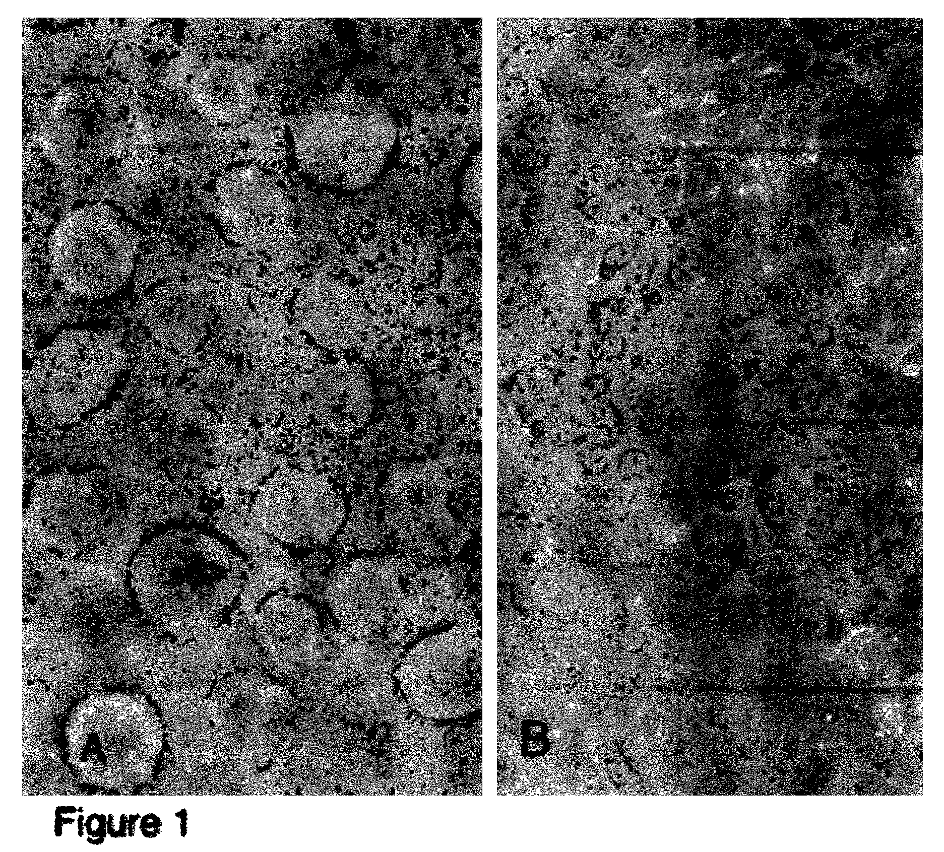 Human pancreatic epithelial progenitor cells and methods of isolation and use thereof