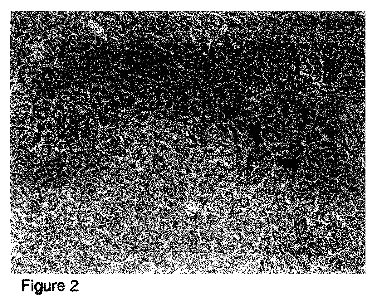 Human pancreatic epithelial progenitor cells and methods of isolation and use thereof