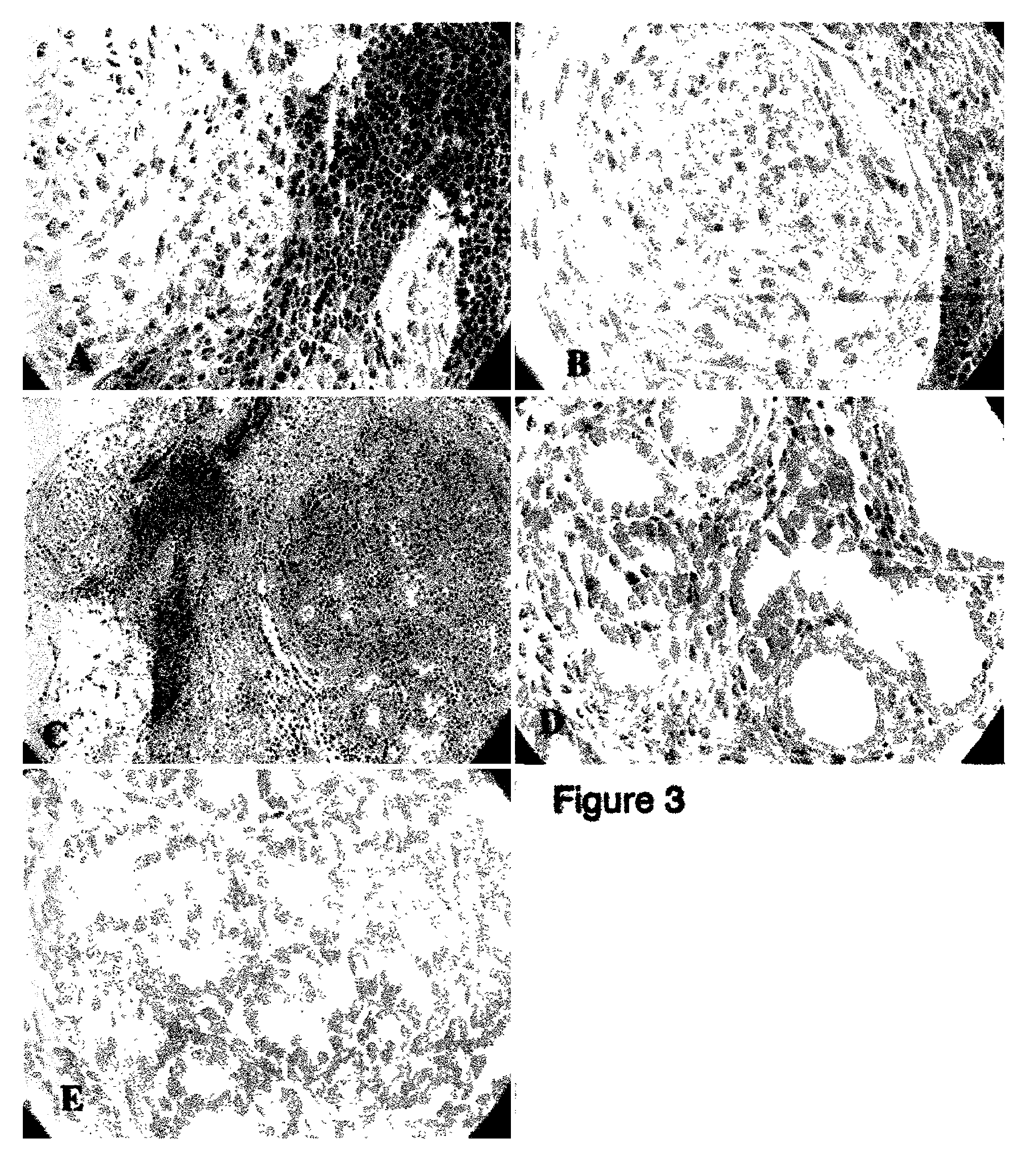 Human pancreatic epithelial progenitor cells and methods of isolation and use thereof