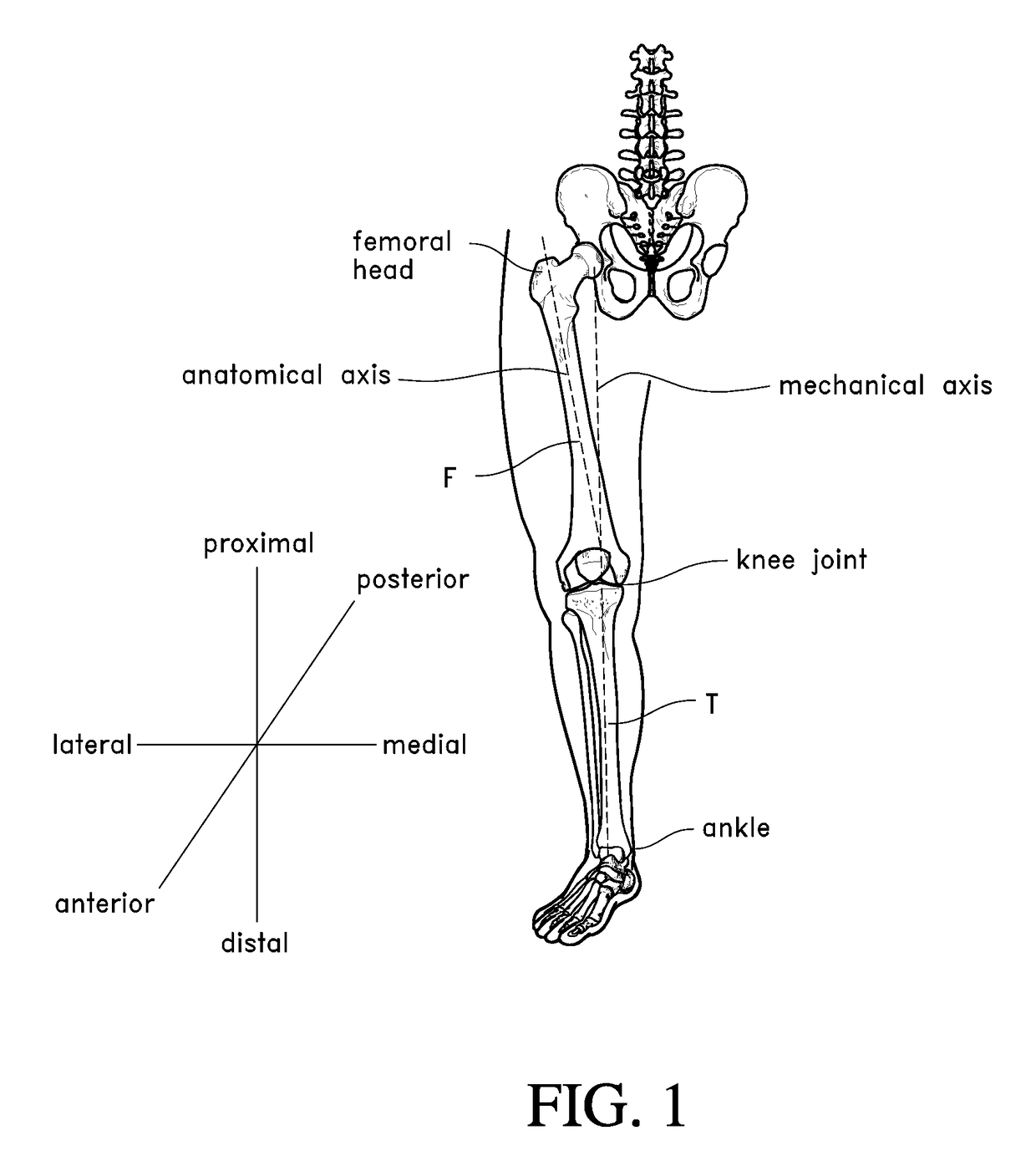 Systems and methods for joint replacement