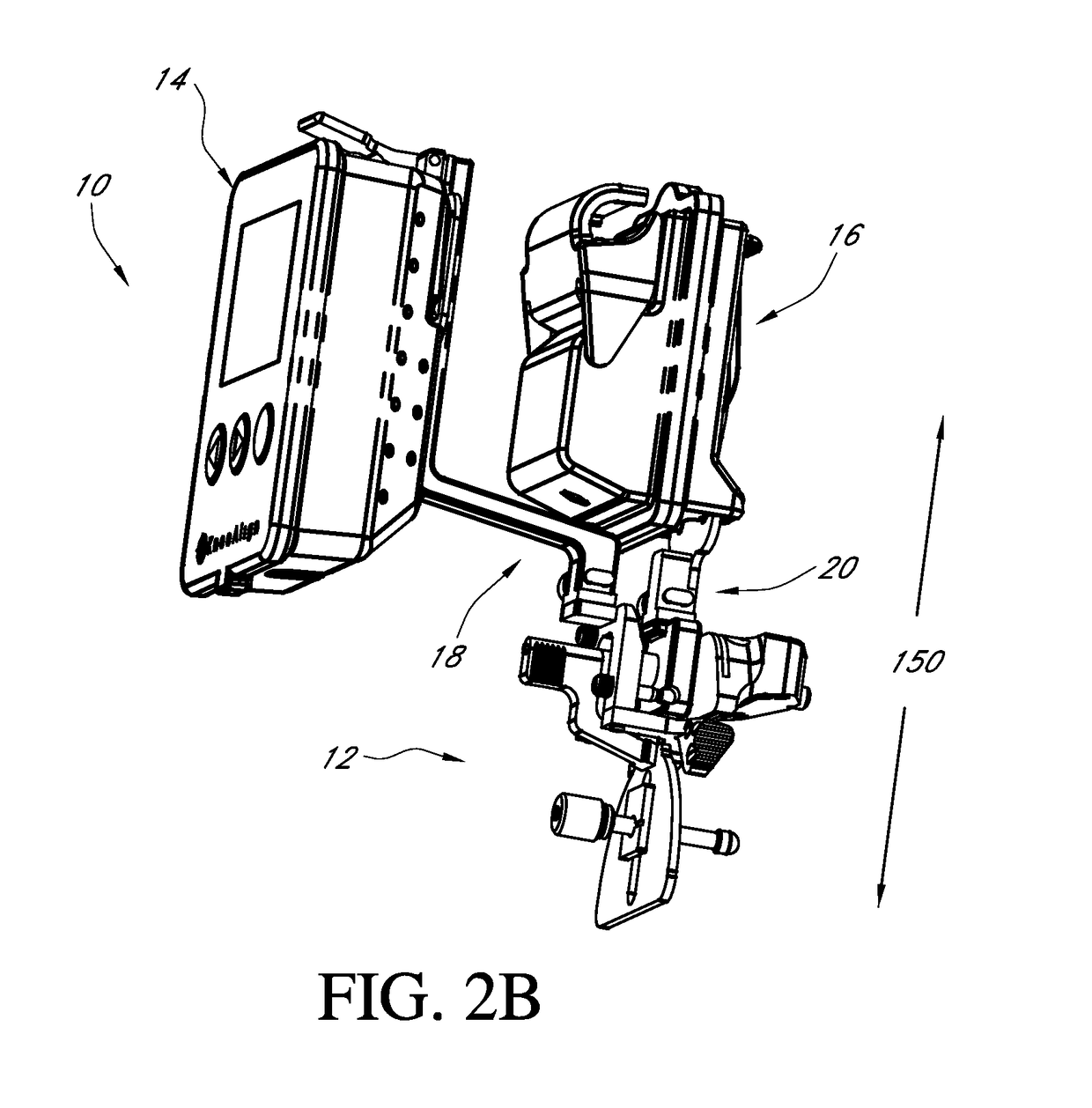 Systems and methods for joint replacement