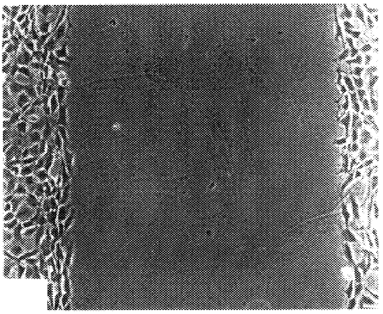 Method for inhibition of bone growth by anionic polymers