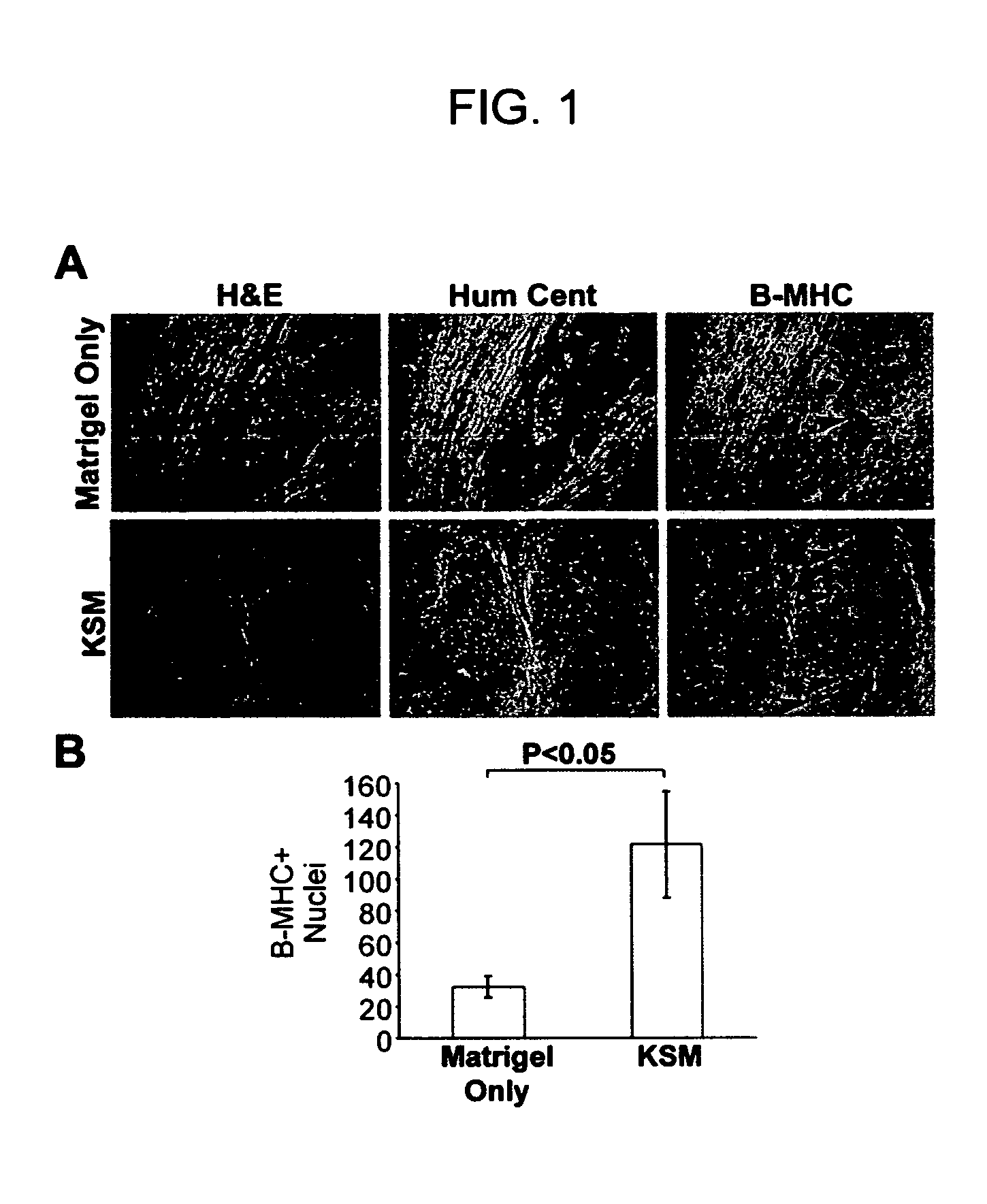 Formulation to improve survival of transplanted cells