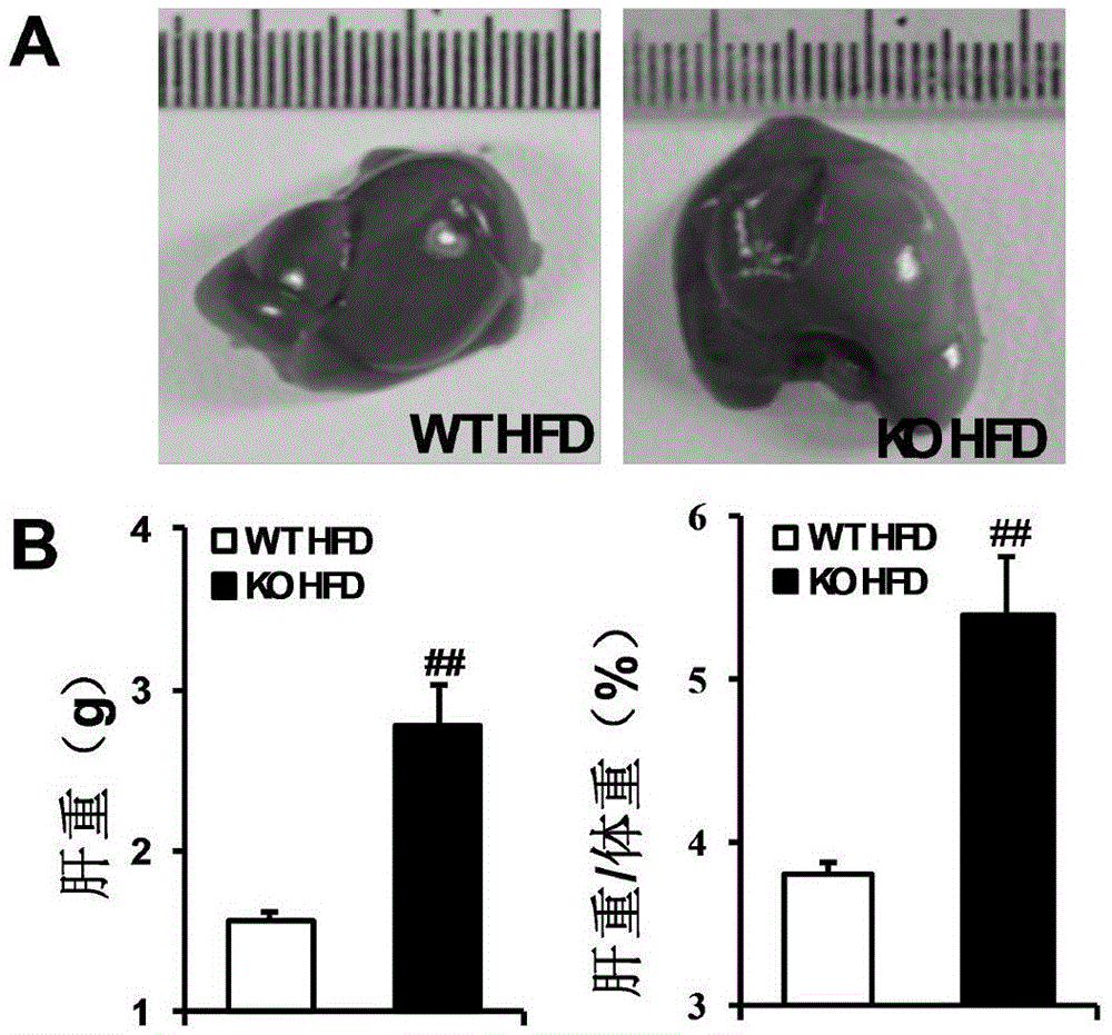 The function and application of nucleotide synthase cad gene in the treatment of fatty liver and type Ⅱ diabetes