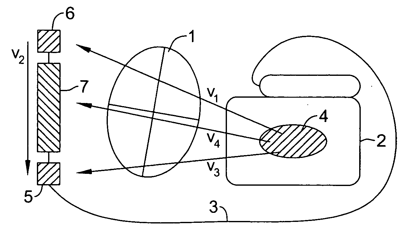 Multiple electrode vectors for implantable cardiac treatment devices