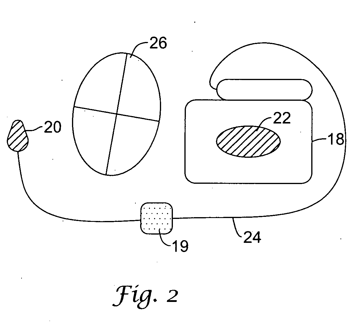 Multiple electrode vectors for implantable cardiac treatment devices