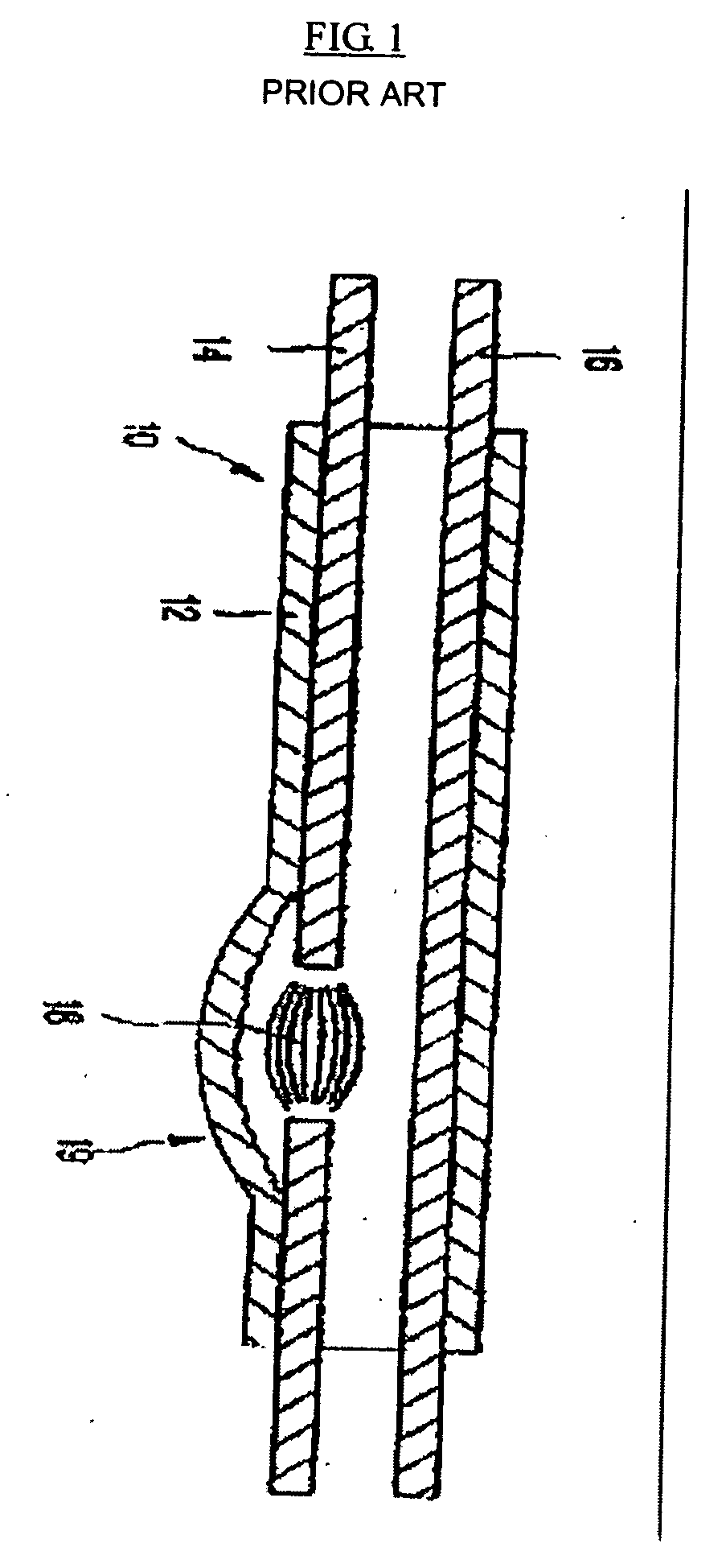 Apparatus for detecting arc fault