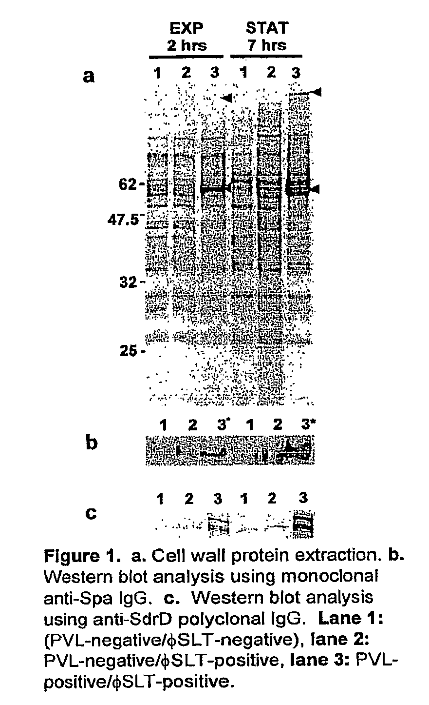 Antibodies recognizing a highly expressed putative antigen of ca-mrsa and methods of use