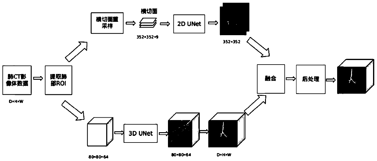 CT image lung trachea segmentation method and system based on deep learning