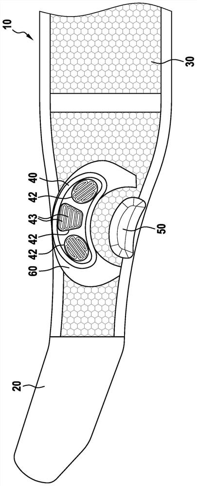 Removable hip orthosis