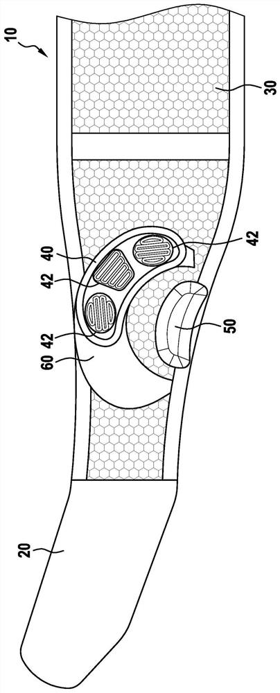 Removable hip orthosis