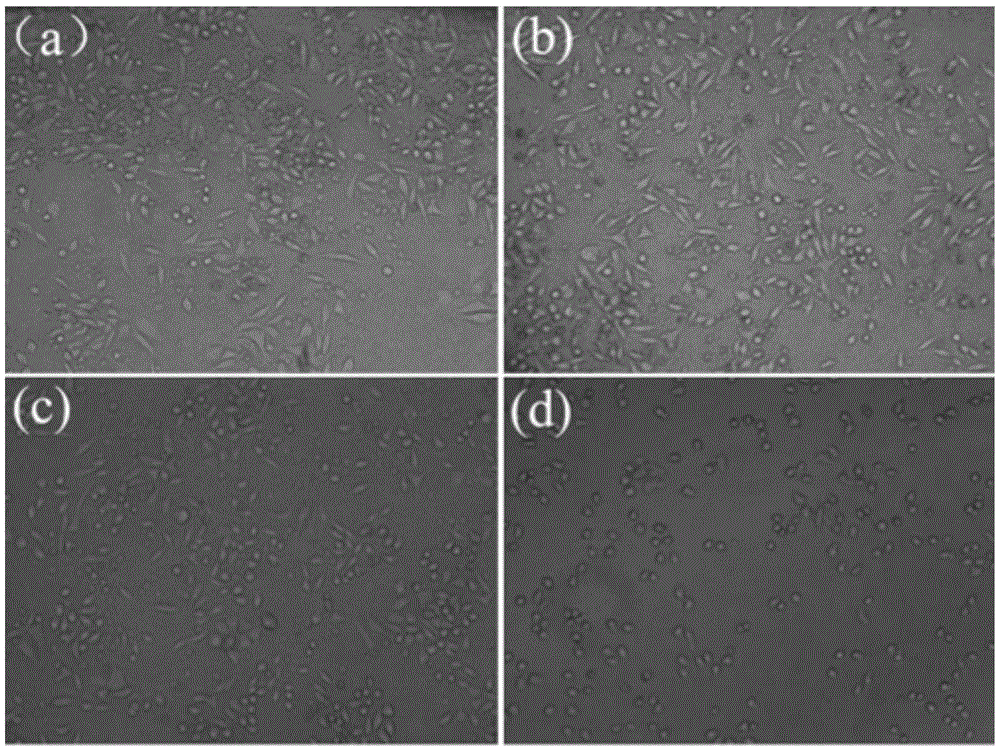 A kind of degradable rare earth magnesium alloy medical biological material and preparation method