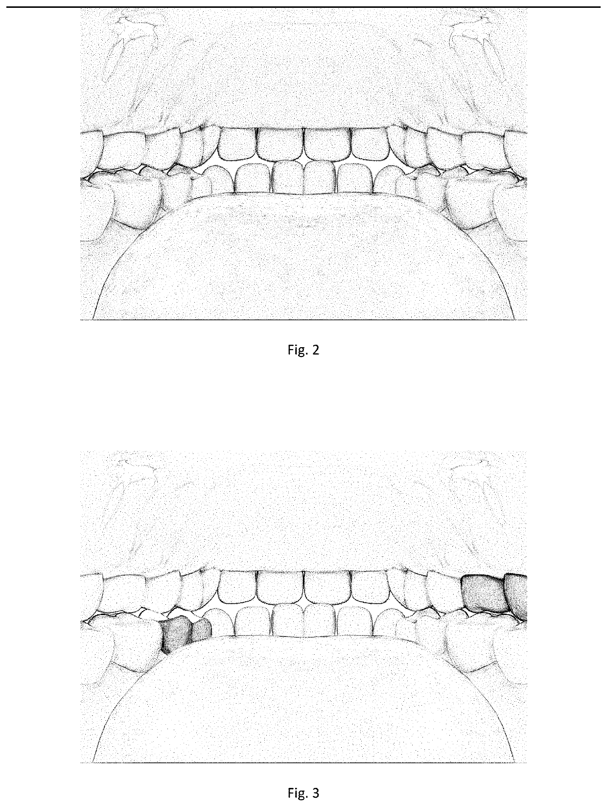 Image processing method and device