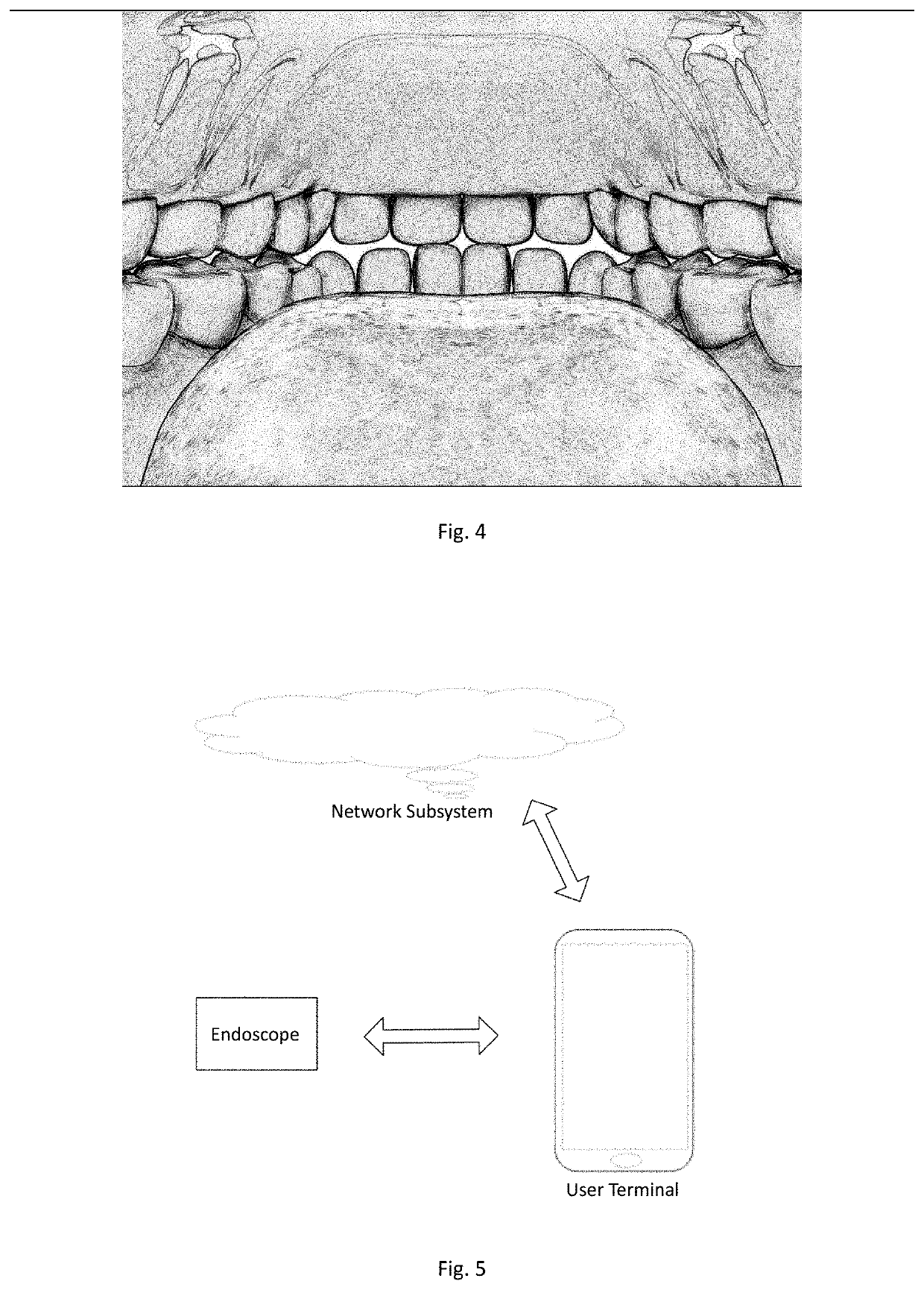 Image processing method and device