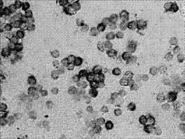 Cancer pathologic evolution early-stage Gankyrin gene mRNA level in-situ hybridization detection kit, detection method and applications thereof