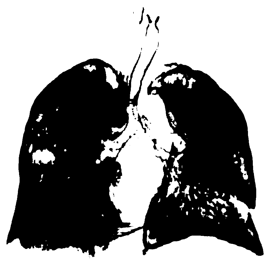 Respiratory motion compensation method for lung percutaneous puncture