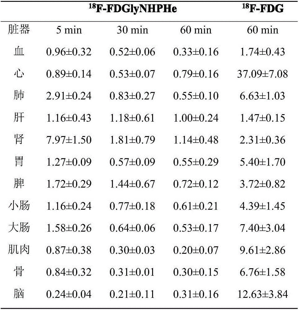 Fluorine-18 marked sugar-based amino acid compound, as well as preparation method and application thereof