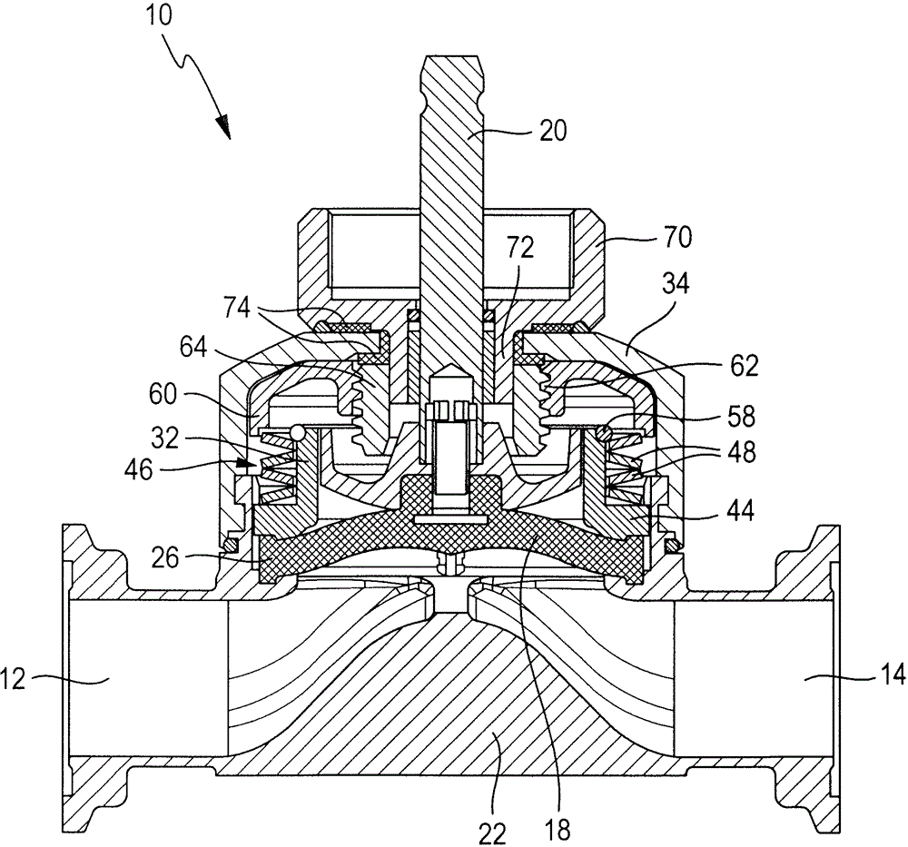 Diaphragm valve