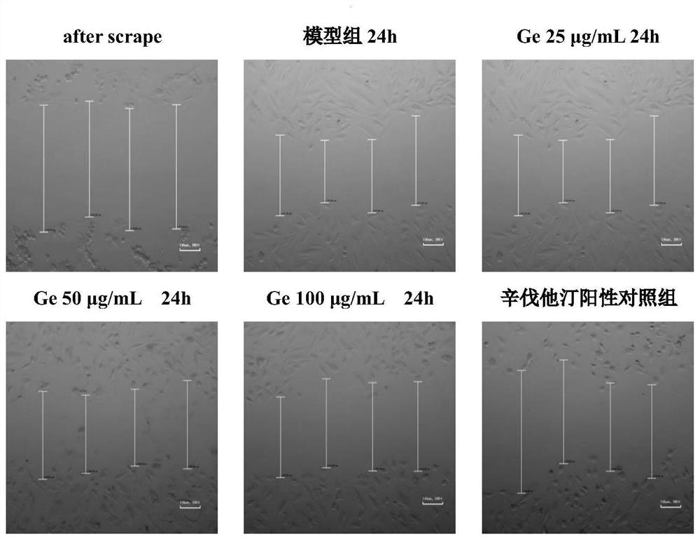 Application of geraniin in preparation of stent coating medicine