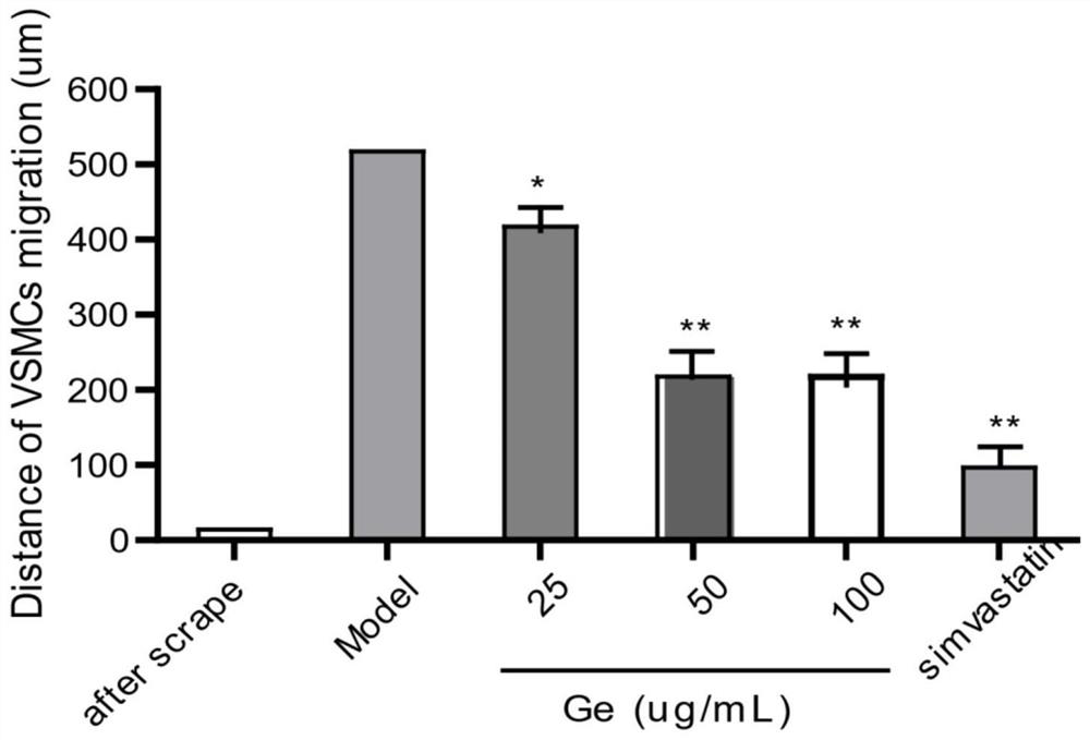 Application of geraniin in preparation of stent coating medicine