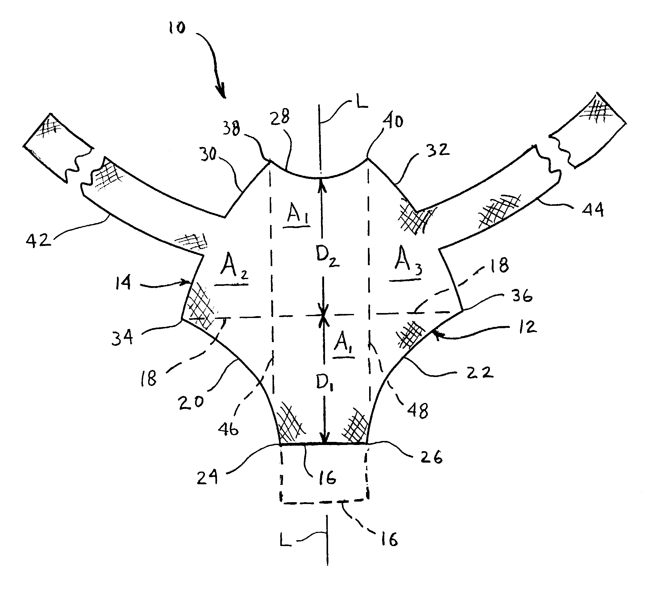 Method and apparatus for treating pelvic organ prolapses in female patients