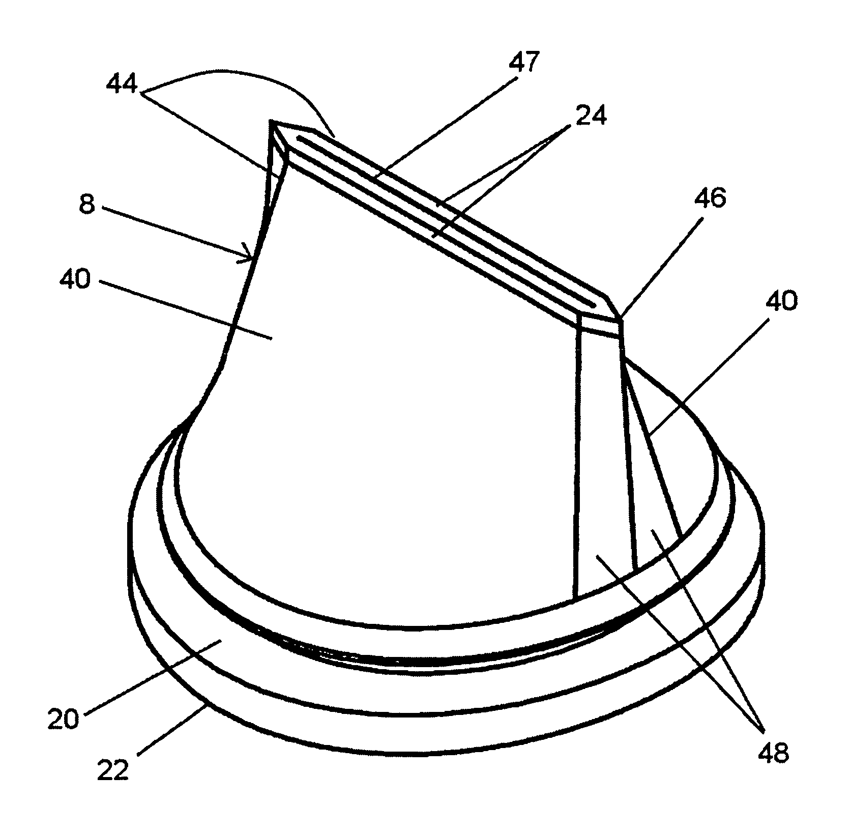 One-way elastomer valve