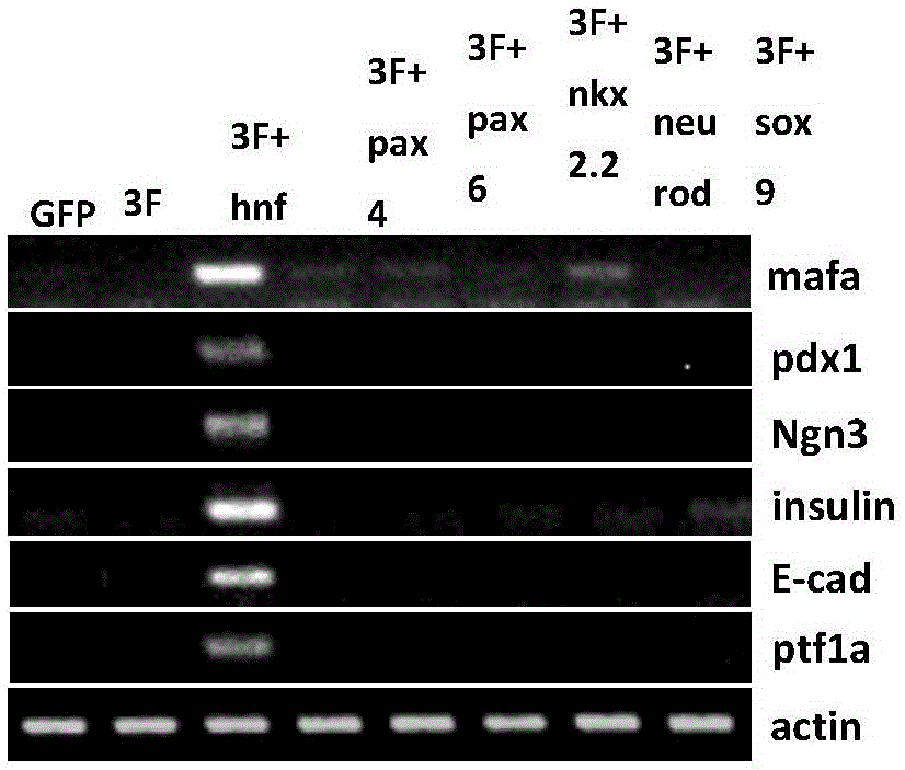 Induction method for insulin secretion cells based on human skin cells and application thereof