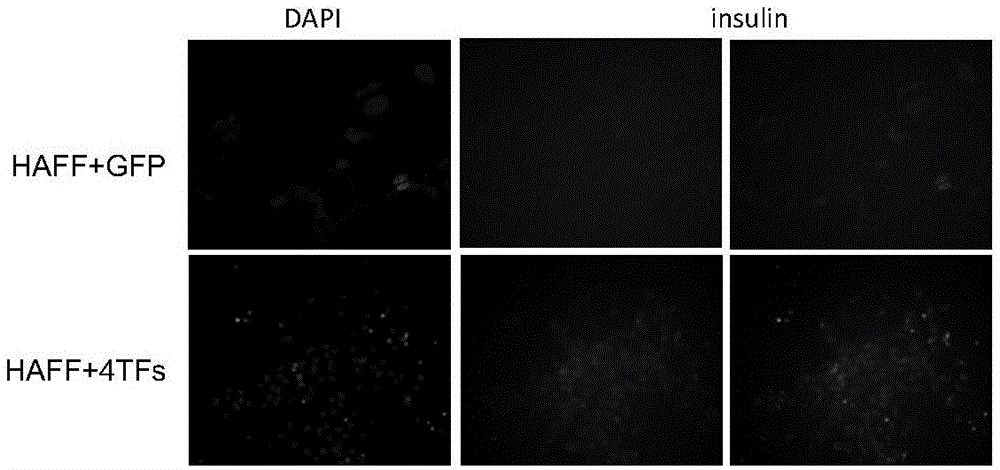 Induction method for insulin secretion cells based on human skin cells and application thereof