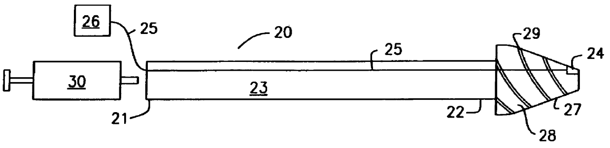 Intrauterine chemical necrosing method, composition, and apparatus